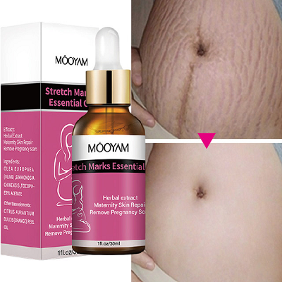 mooyam stretch mark oil